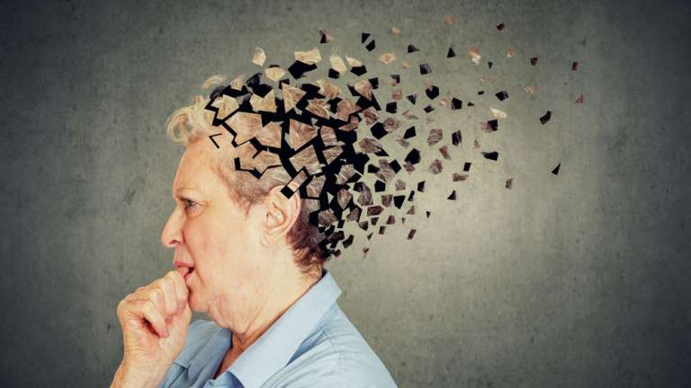 Νόσος Alzheimer