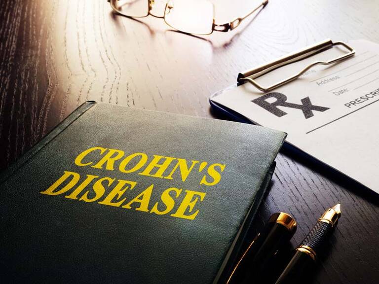 Αντιμετώπιση της Νόσου Crohn του Δωδεκαδακτύλου
