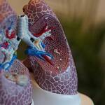 Ο πιο συνηθισμένος λόγος για τον συριγμό στην αναπνοή είναι το άσθμα.
