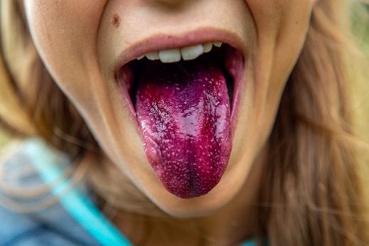 Για πολλούς λόγους μπορεί να έχουμε άσχημη γεύση στο στόμα μας.