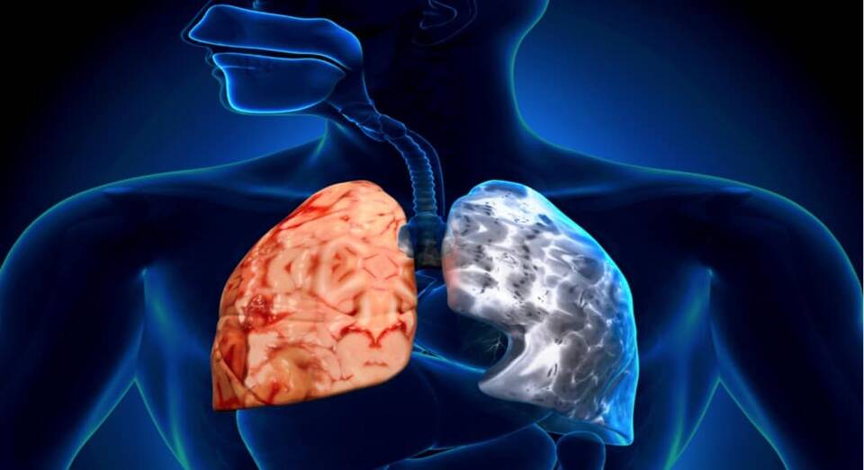 Εάν πάσχετε από ΧΑΠ ή άσθμα, σημειώνουν οι ειδικοί, θα πρέπει να συμβουλευτείτε άμεσα τον ειδικό πνευμονολόγο-φυματιολόγο για να λάβετε τις απαραίτητες ιατρικές οδηγίες.