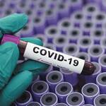 Ο ΕΜΑ Ζητά Πόρους για Κλινικές Δοκιμές με Σκοπό τη Θεραπεία της COVID-19.