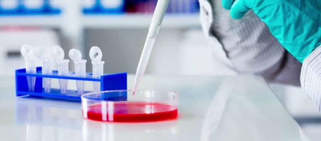 Κορωνοϊός – Η Ελλάδα 25η σε Αριθμό Κρουσμάτων