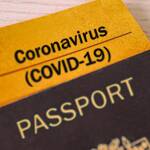 Άρση των Μέτρων Περιορισμού και Ενδεχόμενη Χορήγηση Διαβατηρίων Ανοσίας.