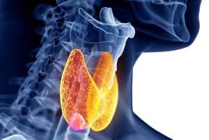 Τα Σημάδια του Καρκίνου του Θυρεοειδούς Αδένα