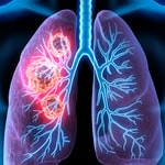 Καρκίνος του Πνεύμονα και Διακοπή Καπνίσματος - Τα Εντυπωσιακά Ευρήματα Νέας Μελέτης