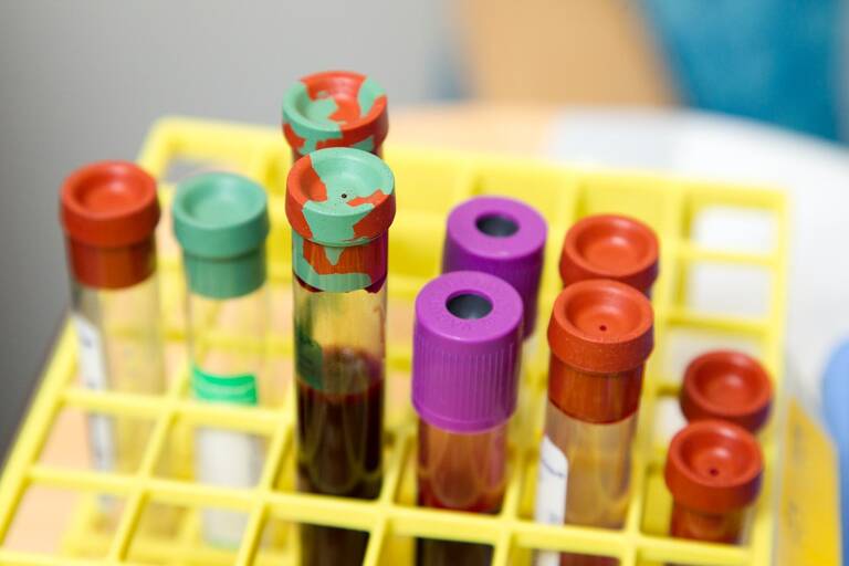 Ανεπάρκεια Οξυγόνου στο Αίμα και Συμπτώματα