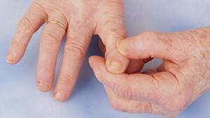 Συμβουλές για την Ανακούφιση από την Οστεοαρθρίτιδα των Χεριών