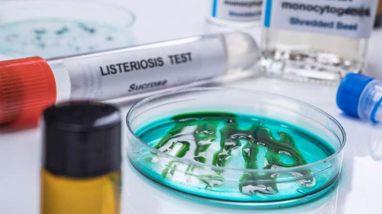 Λιστερίωση και Τοξοπλάσμωση – Πώς να Αποφύγετε αυτές τις Επικίνδυνες για την Εγκυμοσύνη Παθήσεις;