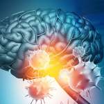 Οι Ασθενείς Covid-19 με Νευρολογικά Συμπτώματα Έχουν Εξαπλάσια Πιθανότητα να Πεθάνουν