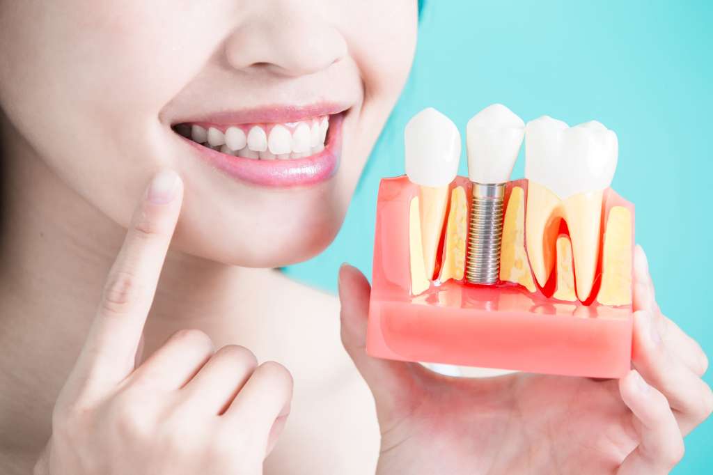 Teeth in a Day – Δόντια σε 1 Ημέρα