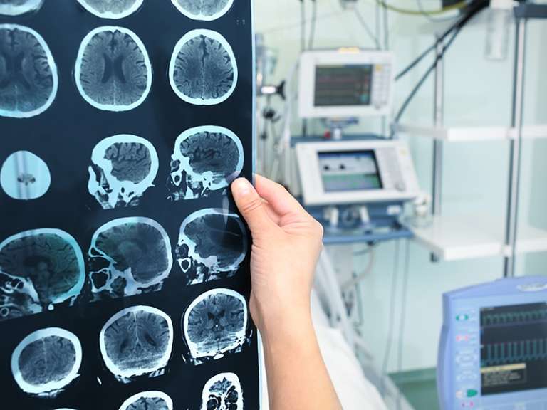 Όγκος Εγκεφάλου – Οι Ελάχιστα Γνωστές Αιτίες