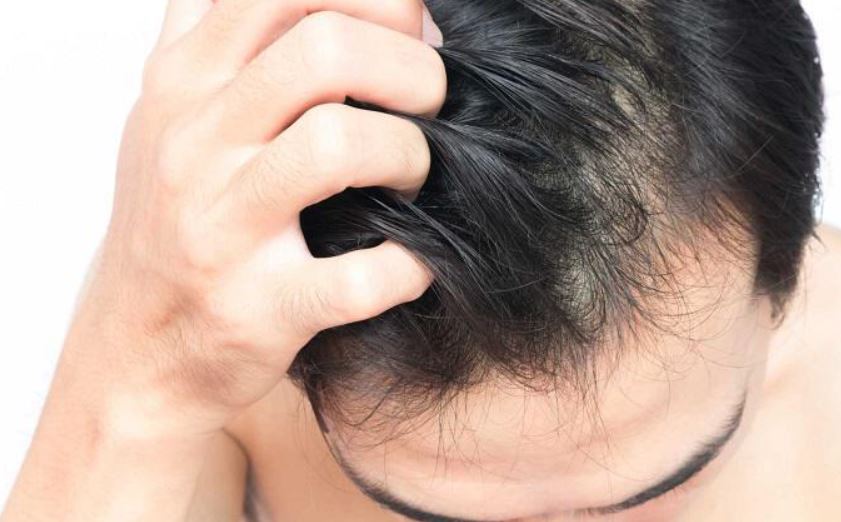 Η υπερβολική απώλεια μαλλιών μπορεί να συμβαίνει ως απάντηση σε κάποιο σωματικό ή ψυχικό στρες στο σώμα.