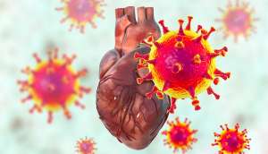 Καρδιαγγειακοί Παράγοντες Κινδύνου και Βαρύτητα Λοίμωξης COVID-19