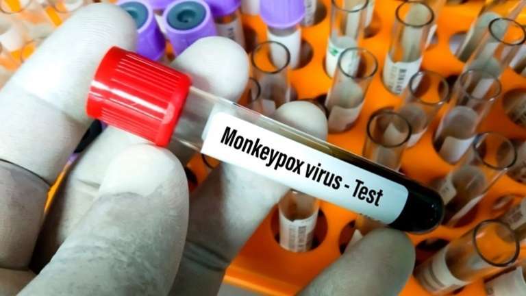 Πάνω από 6.000 Κρούσματα Ευλογιάς των Πιθήκων Έχουν Καταγραφεί σε 58 Χώρες