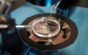 Νέα Πρωτεΐνη Μπορεί να Βελτιώσει τις Θεραπείες Υπογονιμότητας