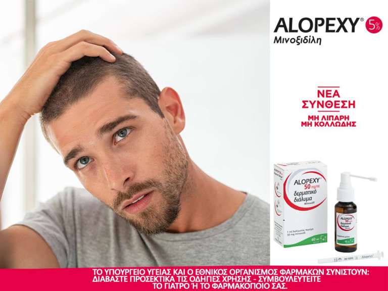 Alopexy – Ο Σύμμαχός σου για να Αντιμετωπίσεις την Τριχόπτωση!