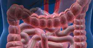 Το ΣΕΕ αποτελεί λειτουργική διαταραχή του εντέρου, κατά την οποία εκδηλώνεται πληθώρα ενοχλητικών συμπτωμάτων, επηρεάζοντας την ποιότητα ζωής του ατόμου