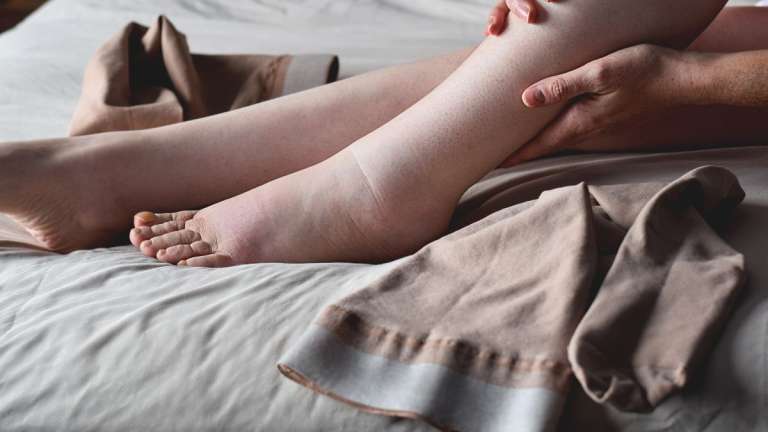 6 Συμβουλές για τα πρησμένα πόδια σας