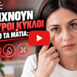 Τι δείχνουν οι μαύροι κύκλοι κάτω από τα μάτια;